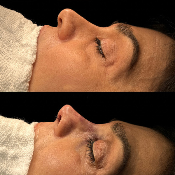 dr-guilherme-sampaio-resultados-antes-e-depois-1