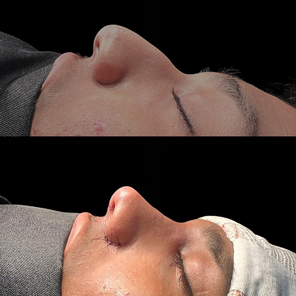 dr-guilherme-sampaio-resultados-antes-e-depois-10