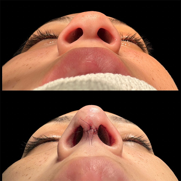 dr-guilherme-sampaio-resultados-antes-e-depois-2