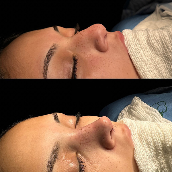 dr-guilherme-sampaio-resultados-antes-e-depois-3